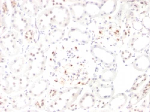WT1 Antibody