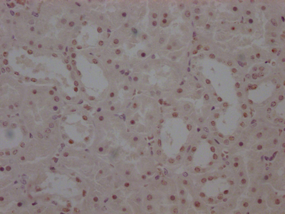 WT1 Antibody