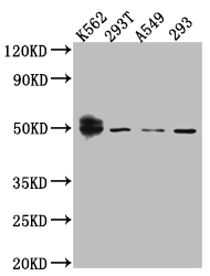 WT1 Antibody