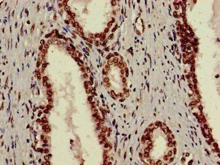 XRCC6 Antibody