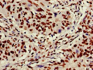 XRCC6 Antibody