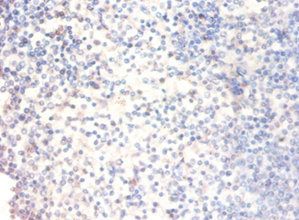 XRCC6 Antibody