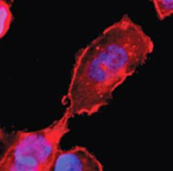 Mouse Human Sphingosine 1 Phosphate 4 Receptor (CT) (EDG6) Antibody