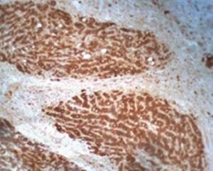 Rabbit Human SPARC Antibody