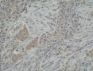 Mouse Human Cytochrome P450 3A5 Antibody