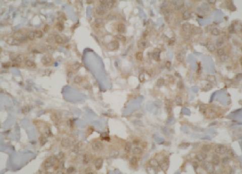 Mouse anti Human Cytochrome P450 3A7 Antibody
