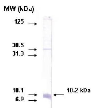 Mouse anti Human Cytochrome p450 26A1 Antibody