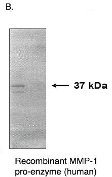 Mouse Human Matrix Metalloproteinase 1 (MMP1) Antibody