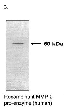 Mouse Human Matrix Metalloproteinase 2 (MMP2) Antibody