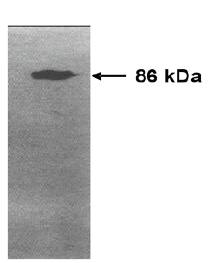 Mouse anti Human Matrix Metalloproteinase 9 (MMP9) Antibody