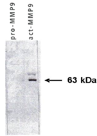 Mouse anti Human Matrix Metalloproteinase 9 (MMP9) Antibody