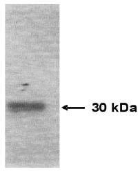 Mouse anti Human Tissue Inhibitor of Matrix Metalloproteinase 1 (TIMP-1) Antibody