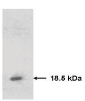 Mouse Human Tissue Inhibitor of Matrix Metalloproteinase 2 (TIMP2) Antibody
