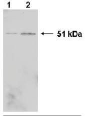 Mouse Human Heterogeneous Nuclear Ribonucleoprotein K Antibody