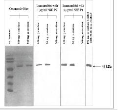 Mouse Human Enolase Antibody