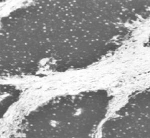Mouse Human Neuron-Specific Enolase Antibody