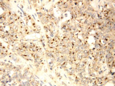 XIAP-associated factor 1 XAF1/XIAP Rabbit Polyclonal Antibody