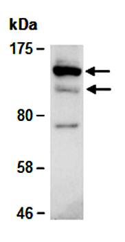 XPC (C) Antibody, Rabbit Polyclonal