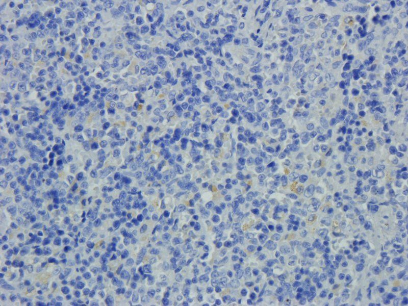 XPNPEP2 Rabbit Polyclonal Antibody