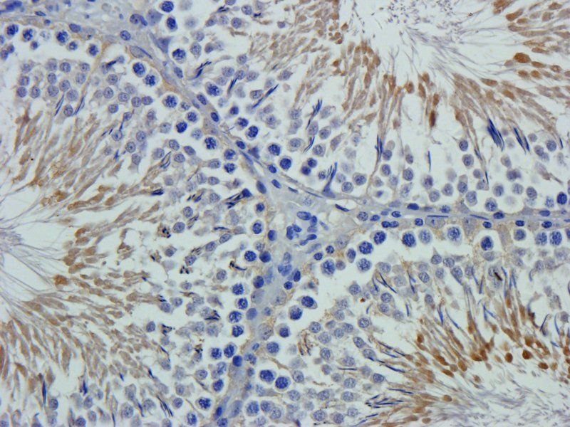 XPNPEP2 Rabbit Polyclonal Antibody