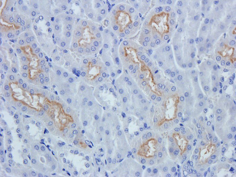 XPNPEP2 Rabbit Polyclonal Antibody