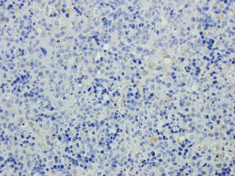 XPNPEP2 Rabbit Polyclonal Antibody