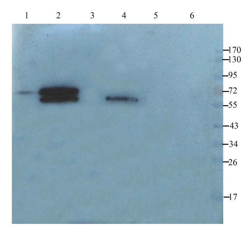 XPNPEP2 Rabbit Polyclonal Antibody