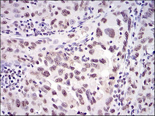 XRCC6 Antibody