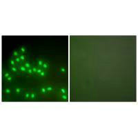 XRCC6/XRCC5 Antibody