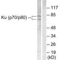 XRCC6/XRCC5 Antibody