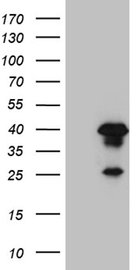 XRN2 Antibody