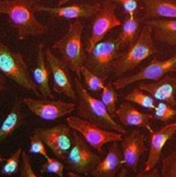 Y14 Monoclonal Antibody