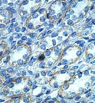 YES1 Rabbit Polyclonal Antibody