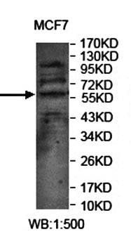 YES1 Rabbit Polyclonal Antibody