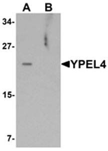 YPEL4 Antibody