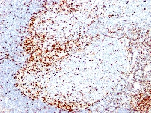 ZAP70 Antibody