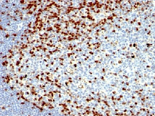 ZAP70 Antibody