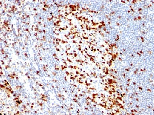 ZAP70 Antibody