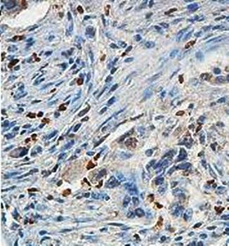 ZBED1 Rabbit Polyclonal Antibody