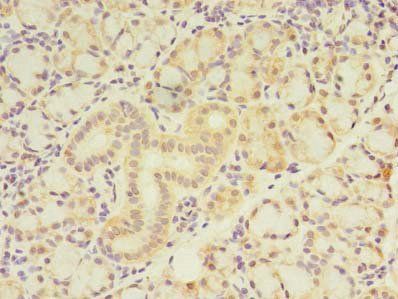 ZBTB18 Antibody