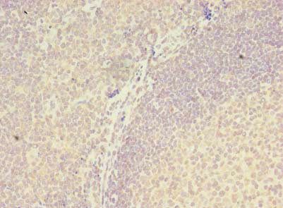 ZBTB18 Antibody