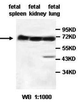 ZBTB22 Rabbit Polyclonal Antibody