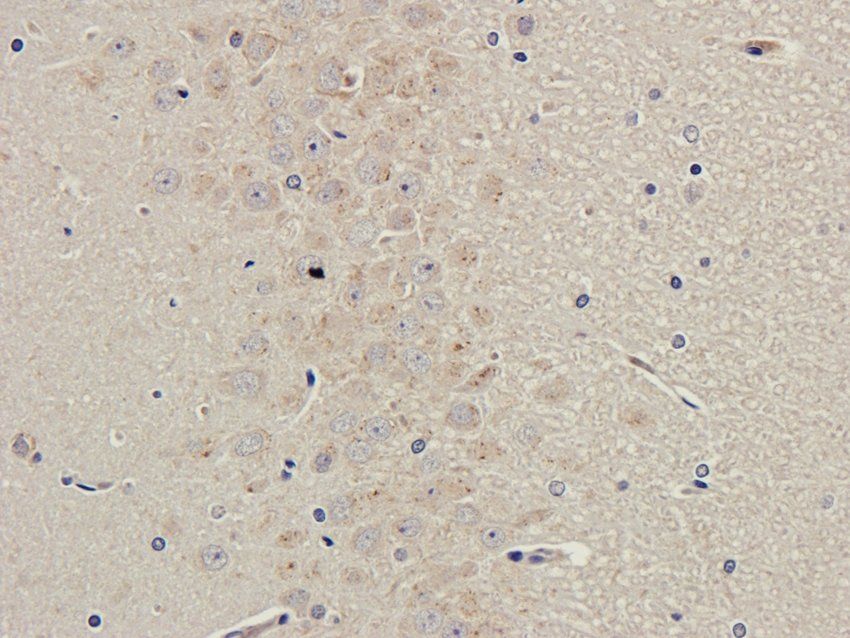 ZDHHC2 antibody
