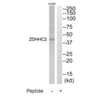 ZDHHC2 Antibody