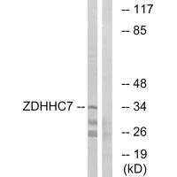 ZDHHC7 Antibody