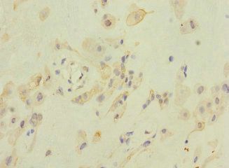 ZFPM2 Antibody