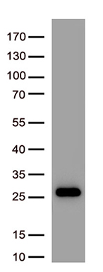Zinc Alpha 2 Glycoprotein Antibody