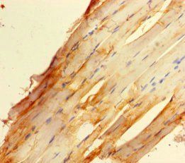 ZBED1 Antibody