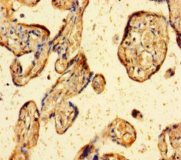 ZBED1 Antibody