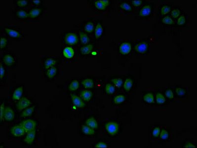 ZMPSTE24 Antibody